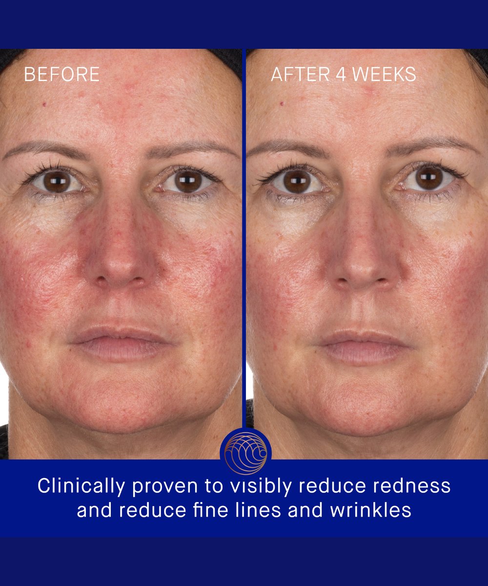Augustinus Bader The Hydrogel Face Mask