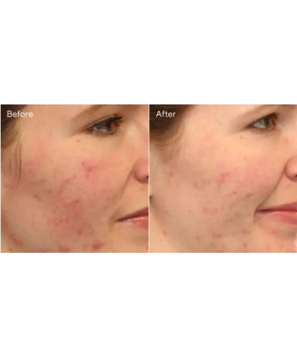 Murad Clarifying Cleanser