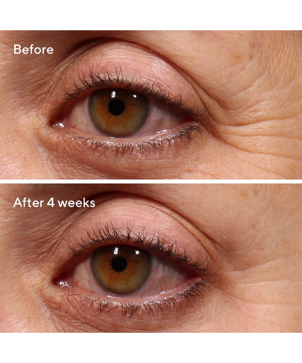 Murad Retinol Youth Renewal Eye Serum