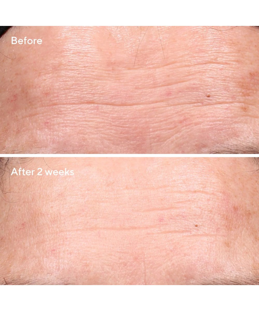 Murad Retinol Youth Renewal Serum