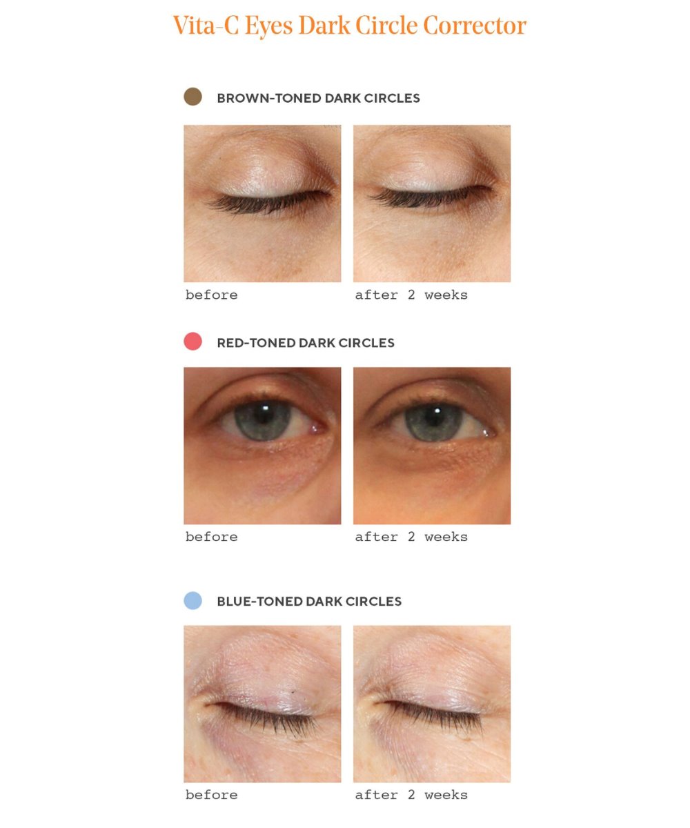 Murad Vita-C Eyes Dark Circle Corrector