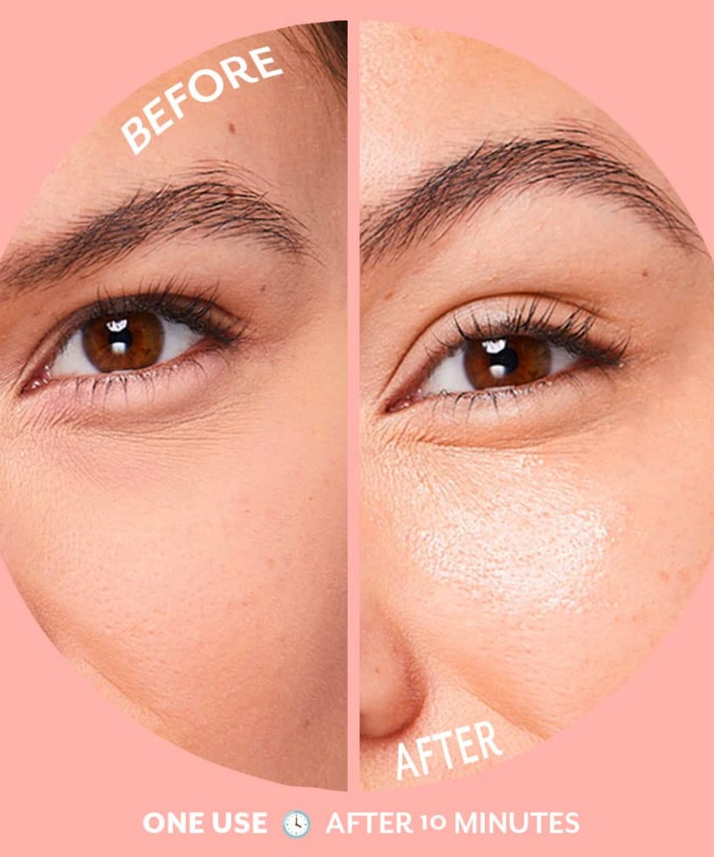 Patchology Serve Chilled Bubbly Eye Gels