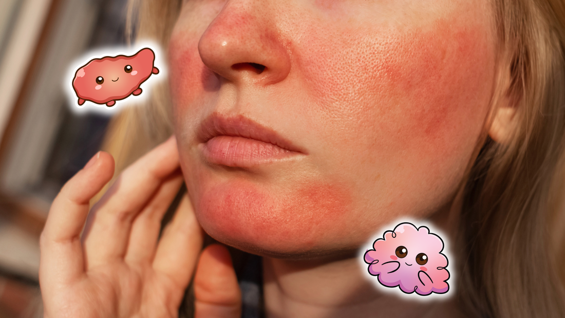 Rosacea Explained: Why Your Skin Is Red, Sensitive, and Reacts Easily