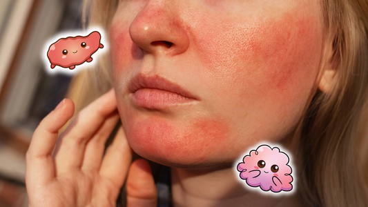 Rosacea Explained: Why Your Skin Is Red, Sensitive, and Reacts Easily