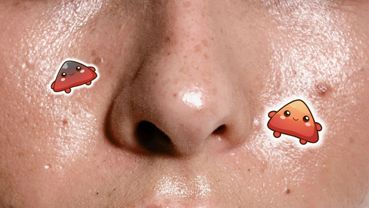 Why Is My Skin So Oily? Understanding Sebum, Shine, and How to Manage It