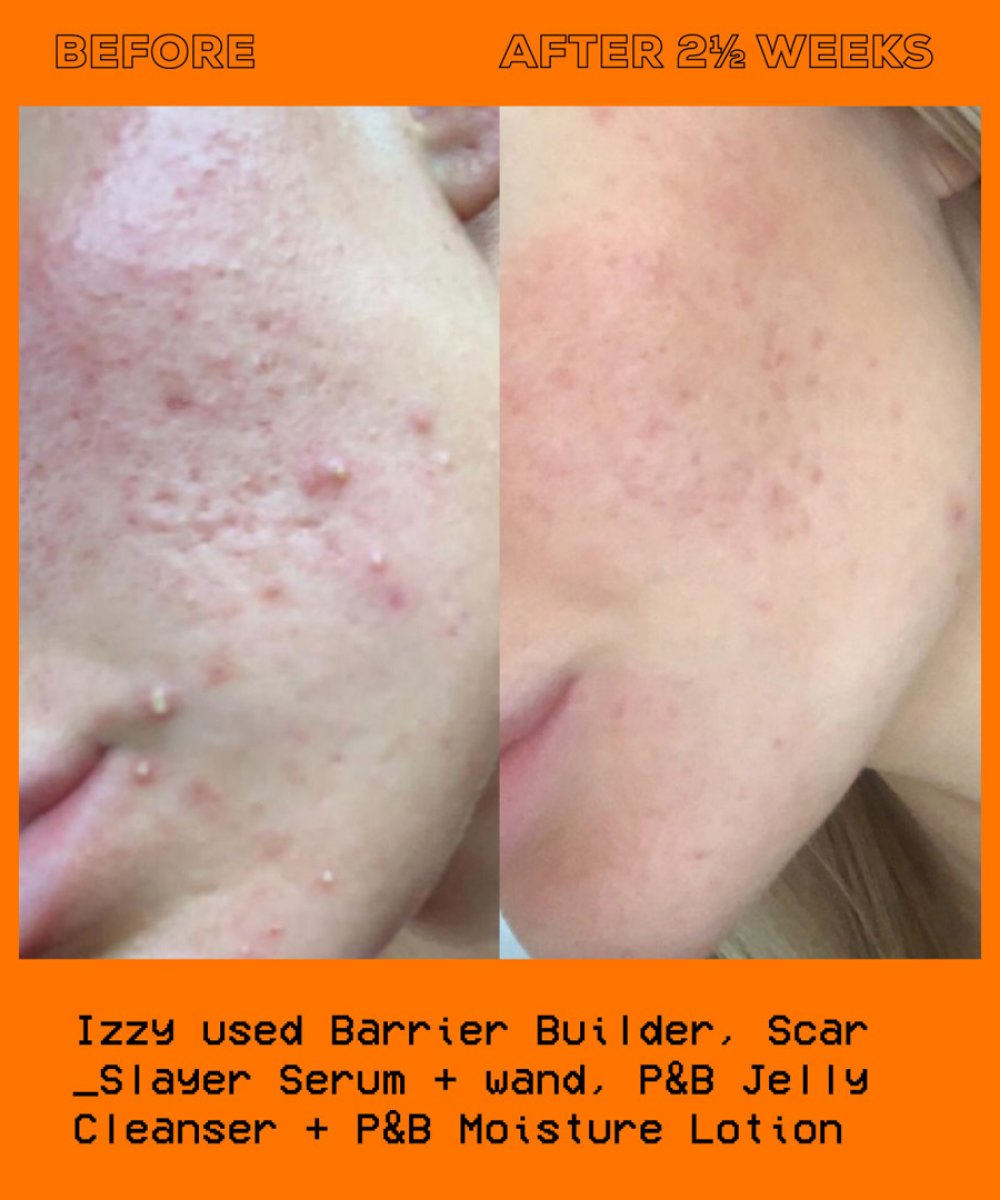 Glow Hub Glow Hub The Scar Slayer Facial Serum 30ml 