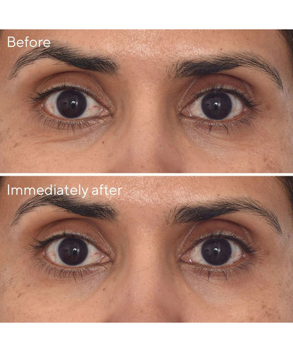 Murad Retinol Youth Renewal Eye Masks 