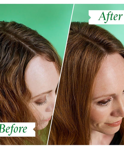 Philip Kingsley Flaky Itchy Dry Shampoo 