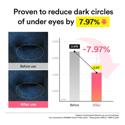 Before and after comparison of dark circles with a graph showing reduction percentage.