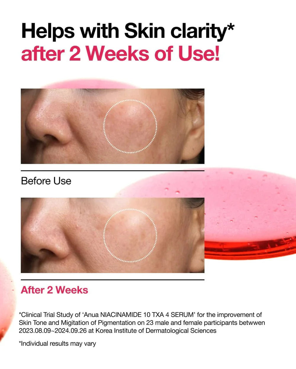 Buy Anua Niacinamide 10% + TXA 4% Dark Spot Correcting Serum 30ml Online in Saudi Arabia - YASHIE SA