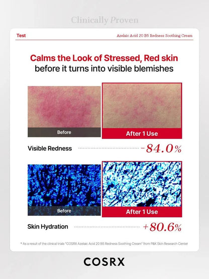 Buy Cosrx Azelaic Acid 20 B5 Redness Soothing Cream 30ml Online in Saudi Arabia - YASHIE SA