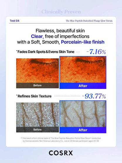 Clinical before and after comparison showing reduced dark spots and refined skin texture with COSRX serum.