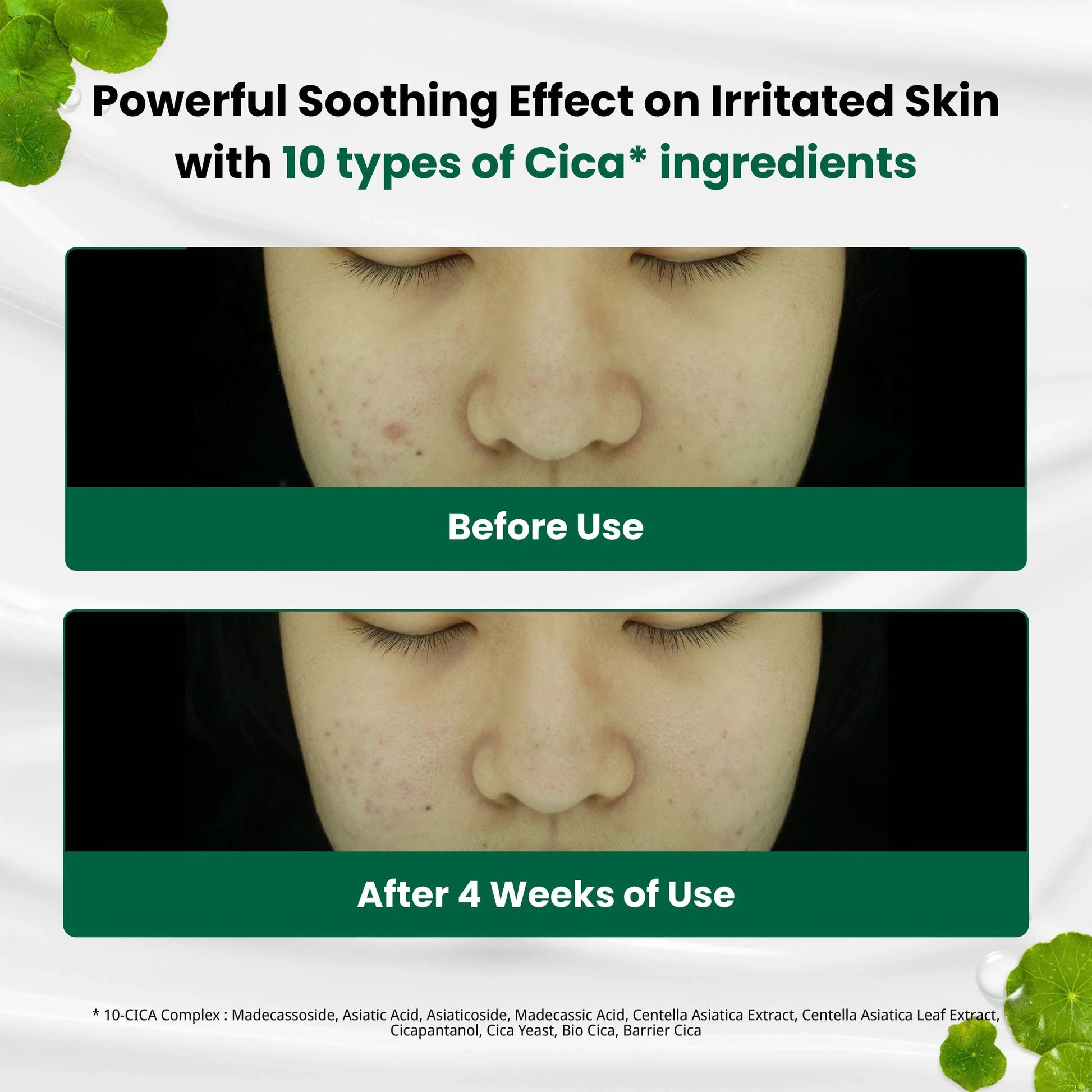 Buy Dr G Red Blemish Clear Soothing Cream 70ml Online in Saudi Arabia - YASHIE SA