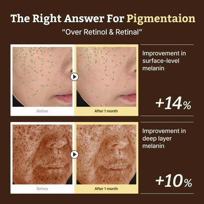 Clinical before and after photos showing a 14% improvement in surface melanin and 10% in deep layer melanin.