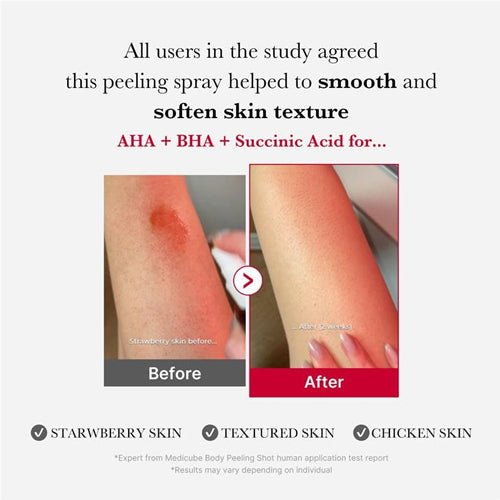 Buy Medicube Medicube Red Glow Acne Care Body Bundle Online in Saudi Arabia - YASHIE SA