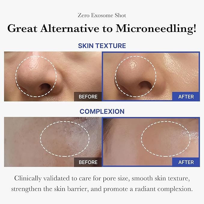 Before and after results for skin texture and complexion showing a smoother, brighter face.