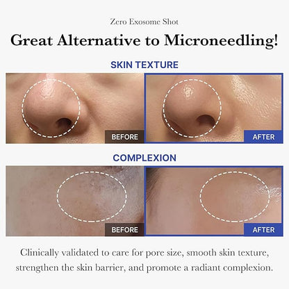 Before and after results for skin texture and complexion showing a smoother, brighter face.