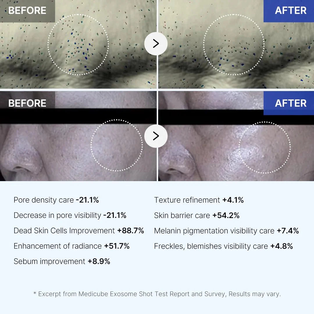 Infographic showing 21% pore visibility reduction and 88% dead skin cell improvement results.