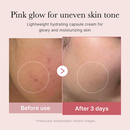Skin results after 3 days of using Medicube PDRN cream showing reduced redness and glow.