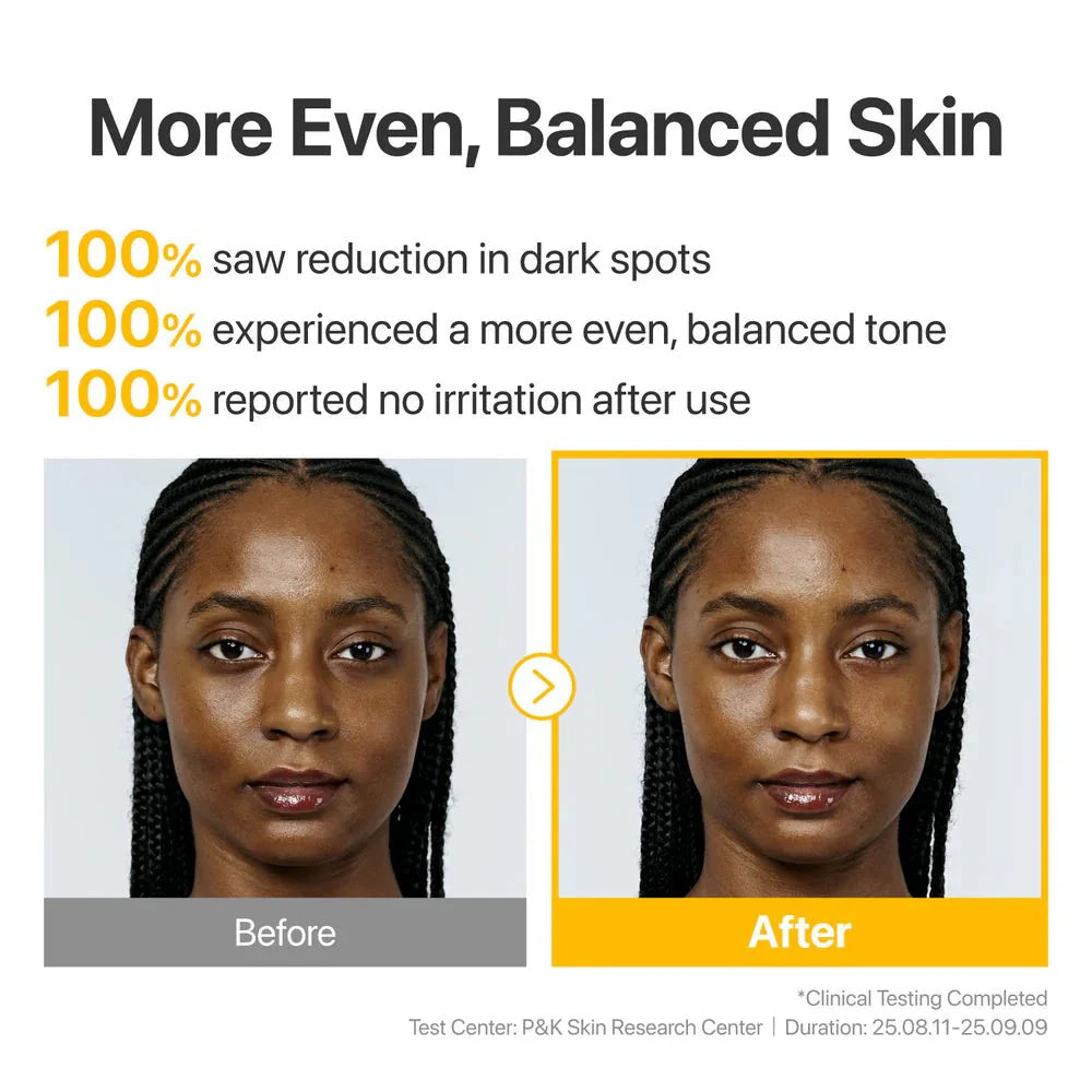 Before and after photos of a woman showing more even and balanced skin tone after use.