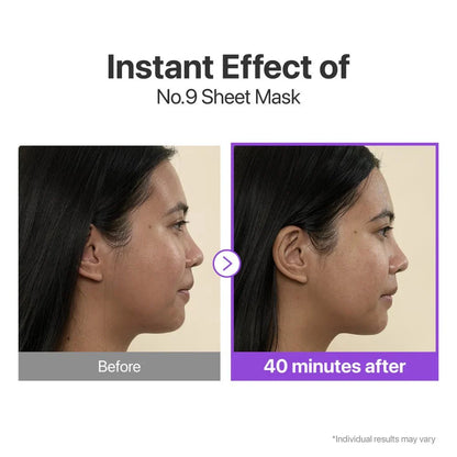 Clinical results showing a 29.22% lifted jawline and improved skin glow after one use.