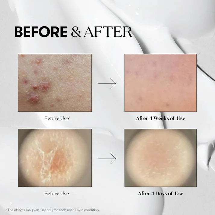 Buy VT Cosmetics Reedle Shot 300 50ml Online in Saudi Arabia - YASHIE SA