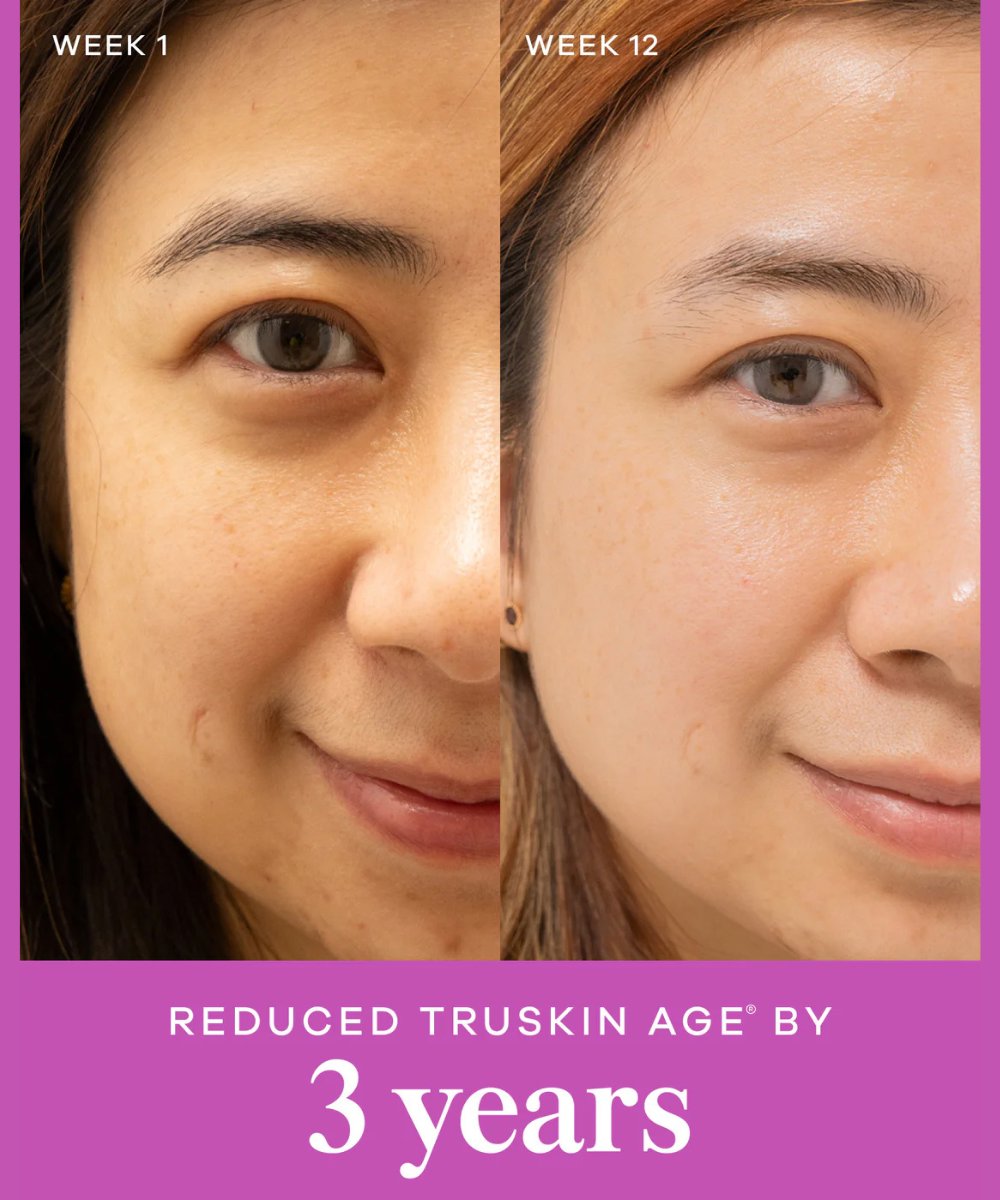 Vida Glow Liquid Collagen Skin + Gut, Tropical 