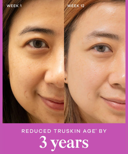 Vida Glow Liquid Collagen Skin + Gut, Tropical 